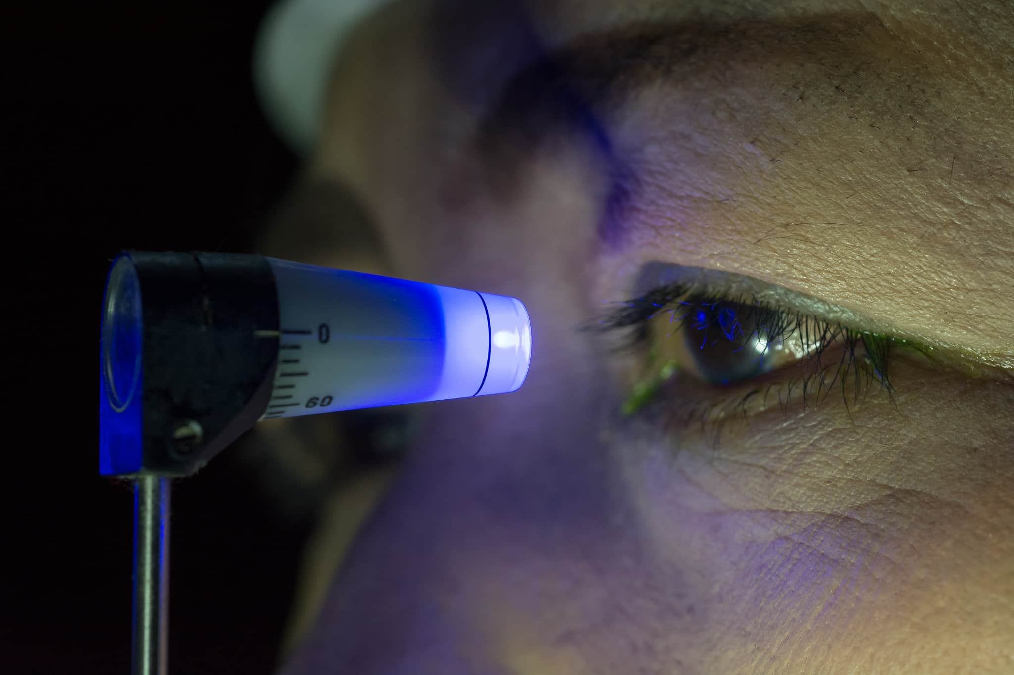 Man having eye pressure tested Man having eye pressure tested